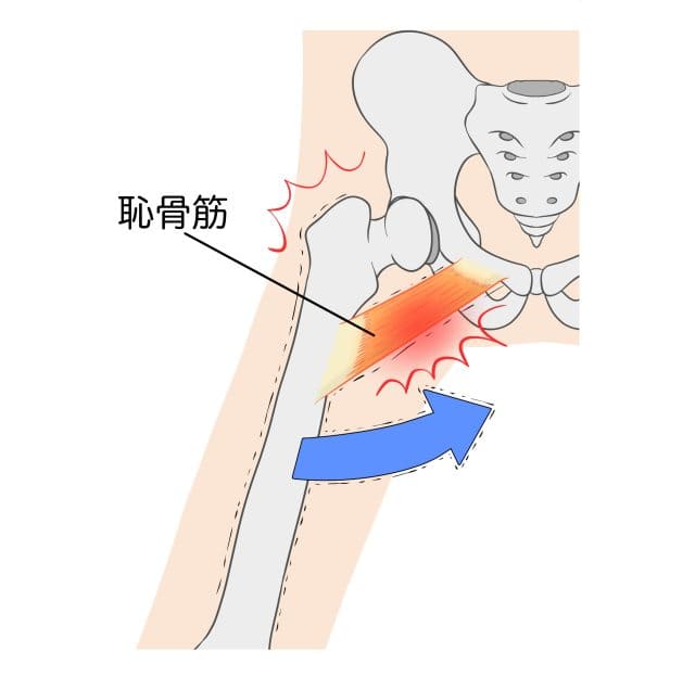 原因図の説明イラスト