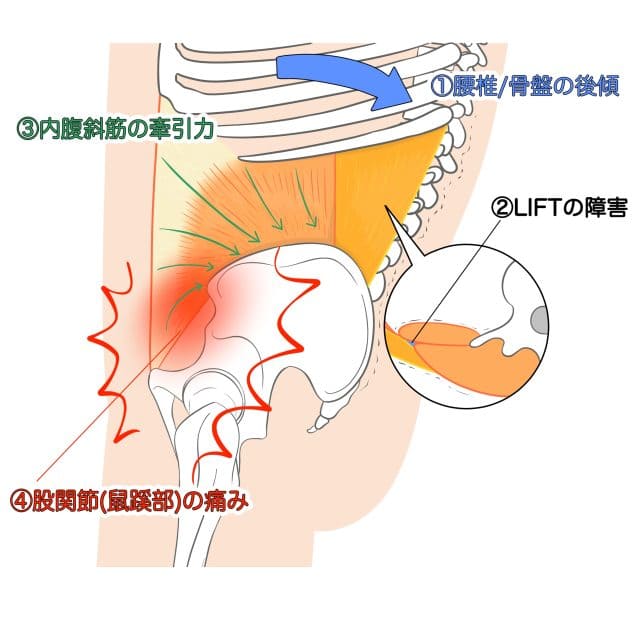 原因図の説明イラスト