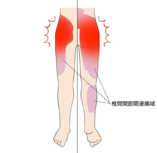 原因図の説明イラスト