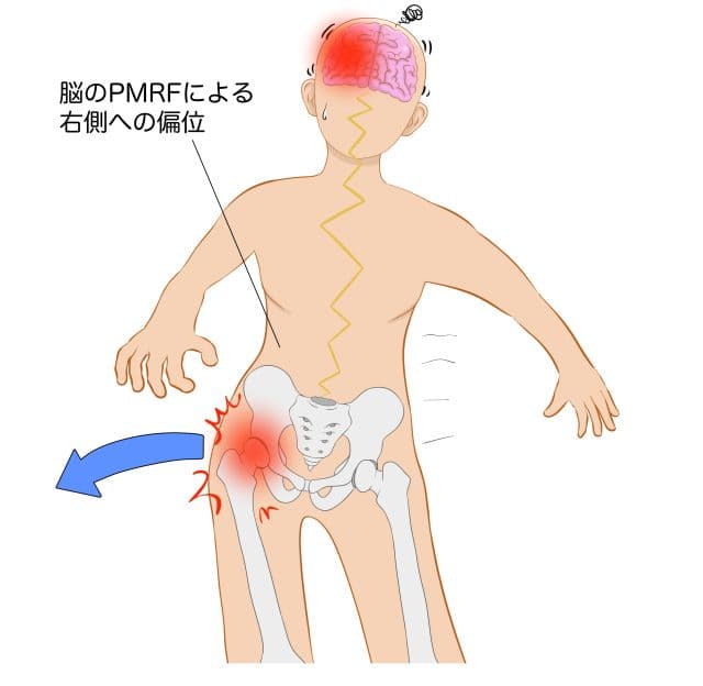 原因図の説明イラスト